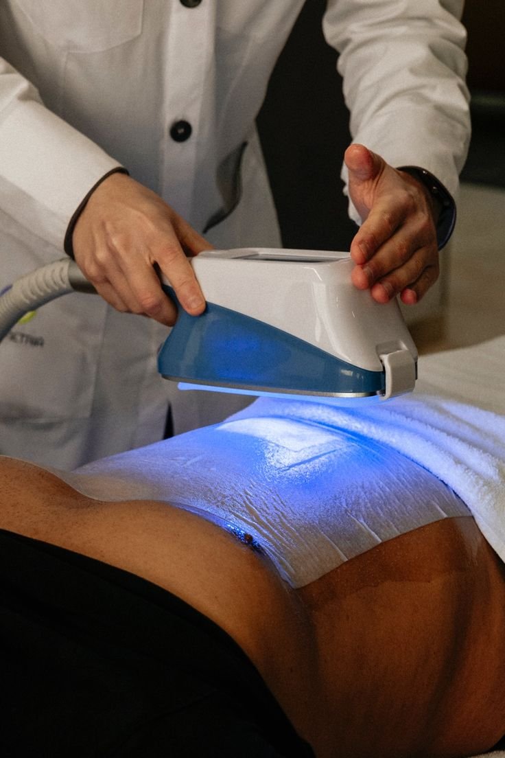 Cryolipolysis